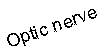 Text Box: Optic nerve